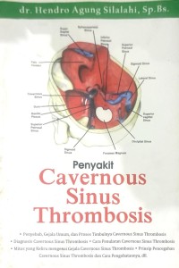 Penyakit Cavernous Sinus Thrombosis